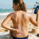 7 Consejos para Cuidar tu Piel Después de Tomar el Sol